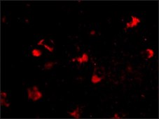 抗RKHD4 兔抗 affinity isolated antibody, buffered aqueous solution