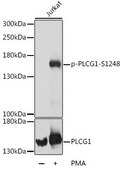 Anti-Phospho-PLCG1-S1248 antibody produced in rabbit