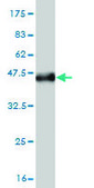 Monoclonal Anti-LGALS1 antibody produced in mouse clone 1E8-1B2, purified immunoglobulin, buffered aqueous solution