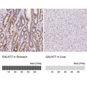 Anti-GALNT7 antibody produced in rabbit Prestige Antibodies® Powered by Atlas Antibodies, affinity isolated antibody, buffered aqueous glycerol solution