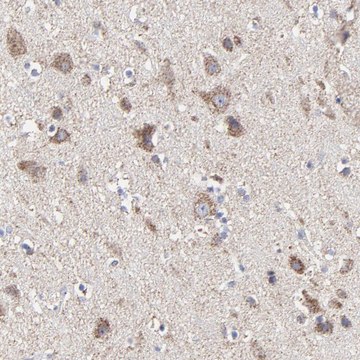 Anti-PINK1 antibody produced in rabbit Prestige Antibodies&#174; Powered by Atlas Antibodies, affinity isolated antibody, buffered aqueous glycerol solution