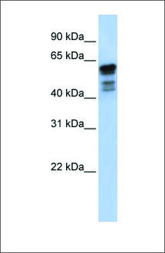 Anti-DES antibody produced in rabbit affinity isolated antibody