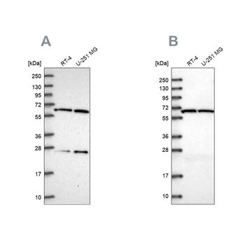 Anti-ACAD9 antibody produced in rabbit Prestige Antibodies&#174; Powered by Atlas Antibodies, affinity isolated antibody