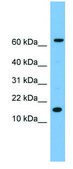 Anti-IL1B (N-terminal) antibody produced in rabbit affinity isolated antibody