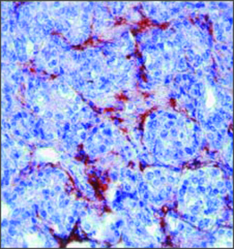 Anti-MMP9 antibody produced in rabbit IgG fraction of antiserum