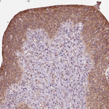 Anti-HAUS5 antibody produced in rabbit Prestige Antibodies&#174; Powered by Atlas Antibodies, affinity isolated antibody, buffered aqueous glycerol solution