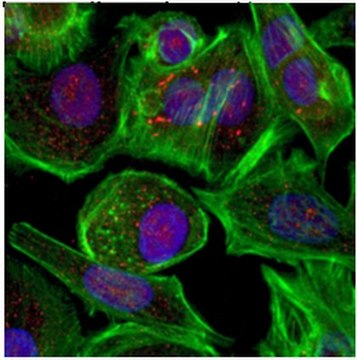 Anti-ANT2 Antibody from rabbit, purified by affinity chromatography