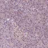 Anti-IWS1 antibody produced in rabbit Prestige Antibodies® Powered by Atlas Antibodies, affinity isolated antibody, buffered aqueous glycerol solution