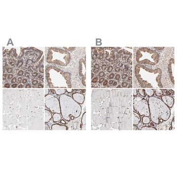 Anti-PDIA3 antibody produced in rabbit Ab2, Prestige Antibodies&#174; Powered by Atlas Antibodies, affinity isolated antibody, buffered aqueous glycerol solution