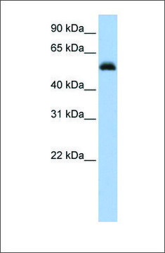 Anti-RUNX1 (ab2) antibody produced in rabbit affinity isolated antibody