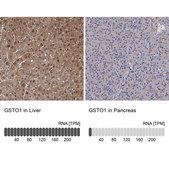 Anti-GSTO1 antibody produced in rabbit Prestige Antibodies® Powered by Atlas Antibodies, affinity isolated antibody, buffered aqueous glycerol solution