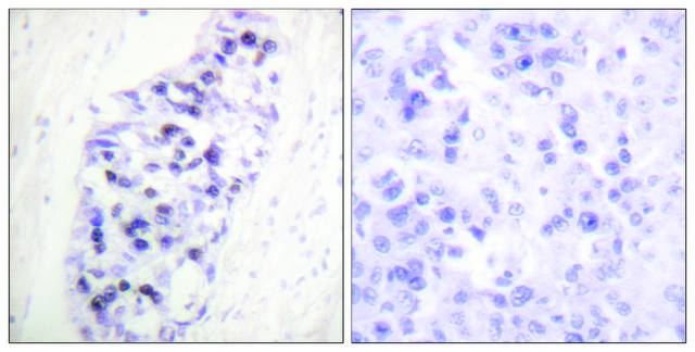 Anti-HDAC1 antibody produced in rabbit affinity isolated antibody