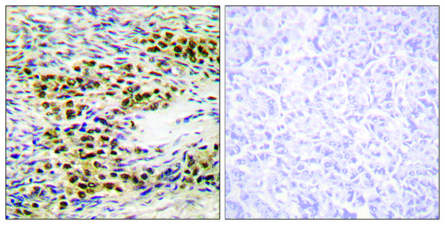 Anti-AKT antibody produced in rabbit affinity isolated antibody