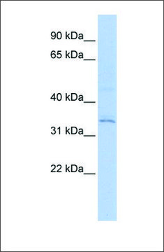 Anti-RNF113A antibody produced in rabbit affinity isolated antibody