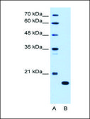 Anti-C8B (AB2) antibody produced in rabbit affinity isolated antibody