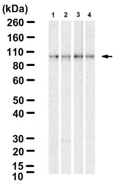 Anti-IKK&#946; Antibody, clone 2N22 ZooMAb&#174; Rabbit Monoclonal recombinant, expressed in HEK 293 cells