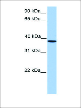 Anti-CSNK2A2 affinity isolated antibody