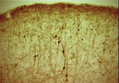 Anti-Calretinin Antibody serum, Chemicon®