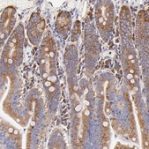 Anti-RPL30 antibody produced in rabbit Prestige Antibodies® Powered by Atlas Antibodies, affinity isolated antibody, buffered aqueous glycerol solution