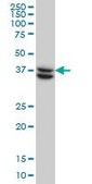 Monoclonal Anti-SUGT1 antibody produced in mouse clone 6G5, purified immunoglobulin, buffered aqueous solution