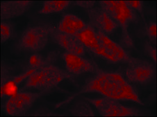 Anti-STMN1 (Ab-38) antibody produced in rabbit affinity isolated antibody