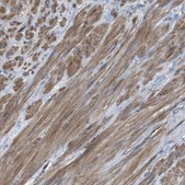 Anti-SLC6A9 antibody produced in rabbit Prestige Antibodies® Powered by Atlas Antibodies, affinity isolated antibody, buffered aqueous glycerol solution