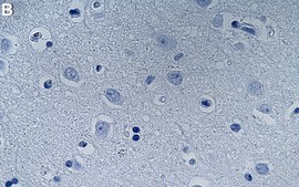 Anti-PHF20 Antibody, clone 1N6 ZooMAb® Rabbit Monoclonal recombinant, expressed in HEK 293 cells