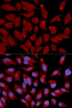 Anti-DNMT3A antibody produced in rabbit