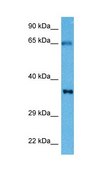 Anti-TNNT2 antibody produced in rabbit affinity isolated antibody