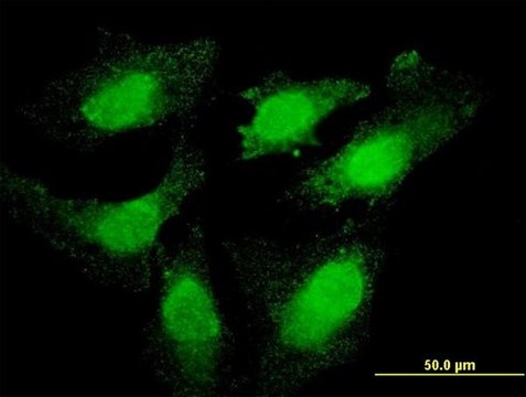 Monoclonal Anti-TOP3B antibody produced in mouse clone 1H4, purified immunoglobulin, buffered aqueous solution