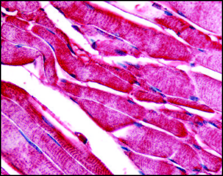 Anti-PYGM antibody produced in rabbit affinity isolated antibody, buffered aqueous solution