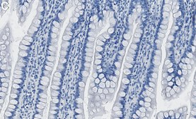 Anti-Cytokeratin-20 Antibody, clone 1E20 ZooMAb® Rabbit Monoclonal recombinant, expressed in HEK 293 cells