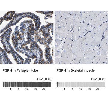 Anti-PSPH antibody produced in rabbit Prestige Antibodies&#174; Powered by Atlas Antibodies, affinity isolated antibody, buffered aqueous glycerol solution