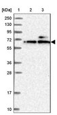 Anti-KLHDC4 antibody produced in rabbit Prestige Antibodies® Powered by Atlas Antibodies, affinity isolated antibody, buffered aqueous glycerol solution