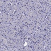 Anti-ERC2 Prestige Antibodies® Powered by Atlas Antibodies, affinity isolated antibody
