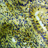 Anti-phospho-Catenin-β (pTyr489) antibody produced in rabbit affinity isolated antibody