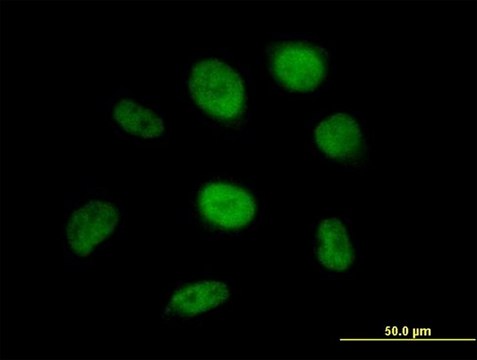 Anti-SS18 antibody produced in mouse purified immunoglobulin, buffered aqueous solution