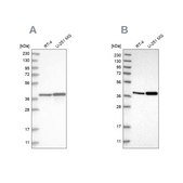 Anti-ECI2 antibody produced in rabbit Prestige Antibodies® Powered by Atlas Antibodies, affinity isolated antibody, buffered aqueous glycerol solution