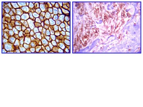 Anti-erbB4 Antibody, clone HFR1/2G4 clone HFR1/2G4, from mouse