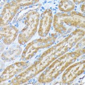 Anti-COPA antibody produced in rabbit