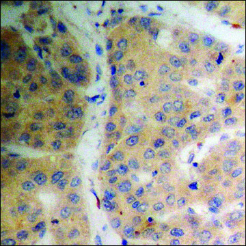 Anti-phospho-SGK (pSer78) antibody produced in rabbit affinity isolated antibody