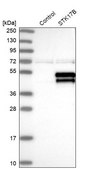 Anti-STK17B antibody produced in rabbit Prestige Antibodies® Powered by Atlas Antibodies, affinity isolated antibody, buffered aqueous glycerol solution