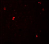 Anti-FBXL16 antibody produced in rabbit affinity isolated antibody, buffered aqueous solution