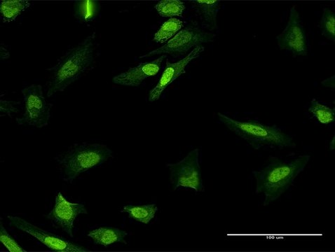 Anti-MPHOSPH8 antibody produced in mouse purified immunoglobulin, buffered aqueous solution