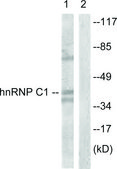 Anti-HNRNP C1 antibody produced in rabbit affinity isolated antibody