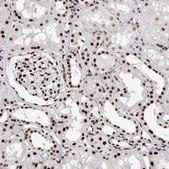 Anti-RBM6 antibody produced in rabbit Prestige Antibodies® Powered by Atlas Antibodies, affinity isolated antibody, buffered aqueous glycerol solution, Ab2