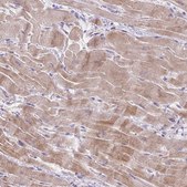 Anti-KRTAP20-3 antibody produced in rabbit Prestige Antibodies® Powered by Atlas Antibodies, affinity isolated antibody, buffered aqueous glycerol solution