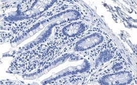 Anti-PUMA Antibody, clone 1L16 ZooMAb® Rabbit Monoclonal recombinant, expressed in HEK 293 cells