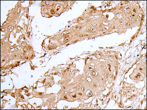 Anti-HOXC9 affinity isolated antibody