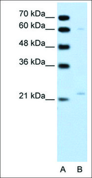 Anti-RGS4 antibody produced in rabbit affinity isolated antibody